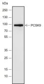 Anti-PCSK9 Rabbit mAb