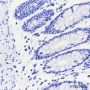 Anti-Myoglobin Rabbit mAb