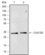 Anti-CLEC2D Rabbit mAb