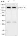 Anti-Pan-Trk Rabbit mAb