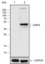 Anti-GIRK2 Rabbit mAb