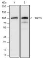 Anti-TOP3B Rabbit mAb