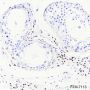 Anti-COUP-TFII Rabbit mAb