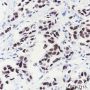 Anti-COUP-TFII Rabbit mAb