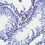 Anti-COUP-TFII Rabbit mAb