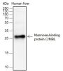 Anti-MBL2 Rabbit mAb