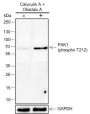 Anti-Phospho-PAK1 (Thr212) Rabbit mAb