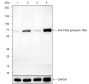 Anti-Phospho-Chk2 (Thr68) Rabbit mAb