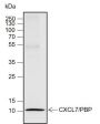 Anti-CXCL7/PBP Rabbit mAb