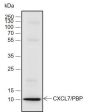 Anti-CXCL7/PBP Rabbit mAb