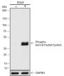 Anti-Phospho-p44/42 MAPK (Erk1/2) (Thr202/Tyr204) Rabbit mAb