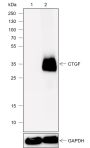 Anti-CTGF Rabbit mAb