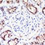 Anti-ACE2 Rabbit mAb