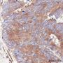 Anti-PKM Rabbit mAb