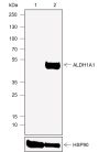 Anti-ALDH1A1 Rabbit mAb
