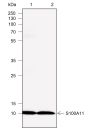 Anti-S100A11 Mouse mAb