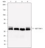 Anti-SET/TAF-I Rabbit mAb