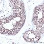 Anti-UBE2L3 Rabbit mAb