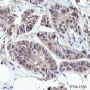 Anti-UBE2L3 Rabbit mAb