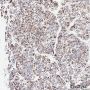 Anti-DLST Rabbit mAb