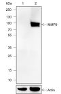 Anti-MMP9 Rabbit mAb