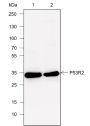 Anti-p53R2 Rabbit mAb