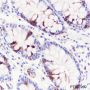 Anti-TACC3 Rabbit mAb