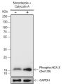 Anti-Phospho-Histone H2A.X (Ser139) Rabbit mAb