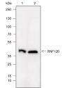 Anti-RNF126 Mouse mAb