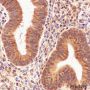 Anti-CIRBP Rabbit mAb