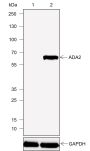 Anti-ADA2 Rabbit mAb