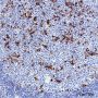 Anti-ADA2 Rabbit mAb