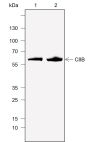 Anti-Complement Factor 8 beta / C8B Rabbit mAb