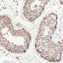 Anti-EID1 Rabbit mAb
