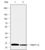 Anti-TRMT112 Mouse mAb