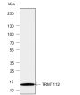 Anti-TRMT112 Mouse mAb