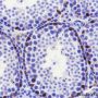 Anti-Tox Rabbit mAb