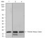Anti-Ferritin Heavy Chain Rabbit mAb