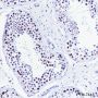 Anti-Rad21 Rabbit mAb
