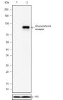 Anti-Glucocorticoid Receptor Rabbit mAb