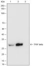 Anti-TFIIF beta Rabbit mAb
