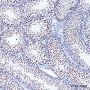 Anti-Cleaved PARP1 p85 Rabbit mAb