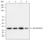 Anti-RPA32/RPA2 Rabbit mAb