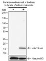 Anti-Malonyl-Histone H3 (Lys23) Rabbit mAb