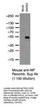 SARS-CoV-2 Nucleocapsid Antibody