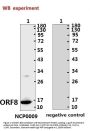 SARS-CoV-2 (COVID-19) ORF8 Antibody (IN)