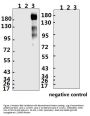 SARS-CoV-2 (COVID-19) Spike S1 Antibody (NT1)