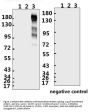 SARS-CoV-2 (COVID-19) Spike S1 Antibody (IN)