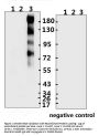 SARS-CoV-2 (COVID-19) Spike S2 Antibody (IN)