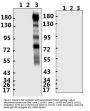 SARS-CoV-2 (COVID-19) Spike S2 Antibody (CT)